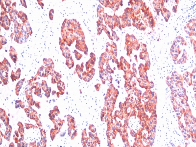 Monoclonal Antibody to Cytokeratin, Basic (Type II or HMW) (Epithelial Marker)(Clone : SPM116)(Discontinued)