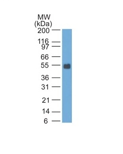 Monoclonal Antibody to Ep-CAM / CD326 (Rat) (Epithelial Marker)(Clone : SPM535)