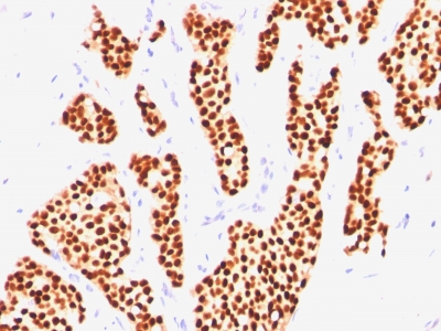 Monoclonal Antibody to Estrogen Receptor (Marker of Estrogen Dependence)(Clone : SPM567)