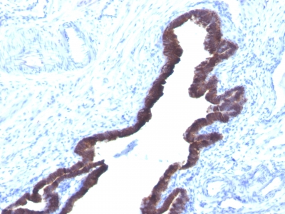 Monoclonal Antibody to Cytokeratin 8/18(K8.8 + DC10)