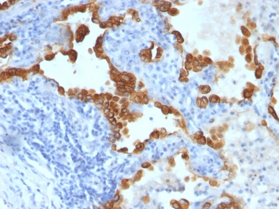 Monoclonal Antibody to Cytokeratin 8/18(Clone : SPM141)(Discontinued)