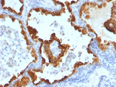 Monoclonal Antibody to Cytokeratin 8/18(C-43 + DC10)