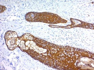 Monoclonal Antibody to Cytokeratin, Basic (Type II or HMW) (Epithelial Marker)(Clone : KRTH/1076)