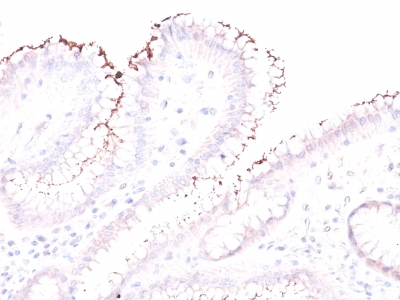 Polyclonal Antibody to Helicobacter Pylori