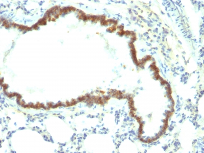 Monoclonal Antibody to Ep-CAM / CD326 (Rat) (Epithelial Marker)(Clone : Epcam/1158)