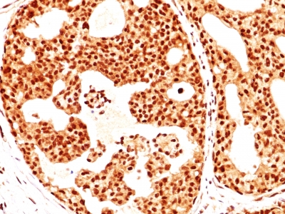 Monoclonal Antibody to ER-beta1 (Estrogen Receptor beta-1)(Clone : ERb455)