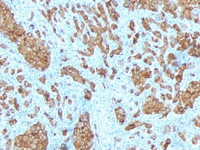 Monoclonal Antibody to MART-1 / Melan-A / MLANA (Melanoma Marker)(Clone : SPM342)