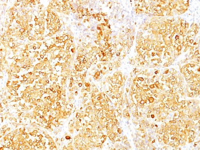 Monoclonal Antibody to MART-1 / Melan-A / MLANA (Melanoma Marker)(Clone : M2-9E3)