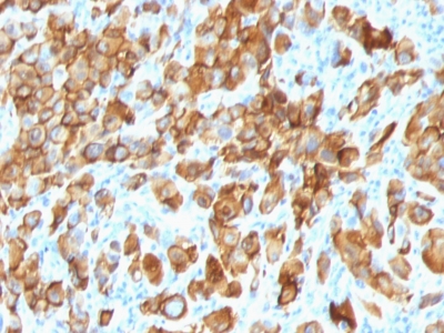 Monoclonal Antibody to MART-1 / Melan-A / MLANA (Melanoma Marker)(Clone : SPM540)