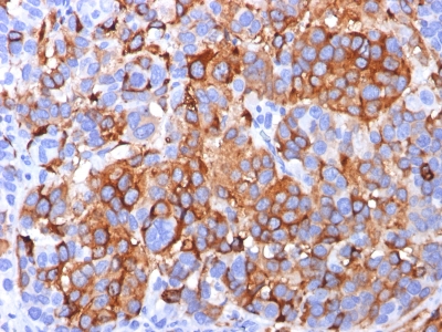 Monoclonal Antibody to MART-1 / Melan-A / MLANA (Melanoma Marker)(Clone : A103)