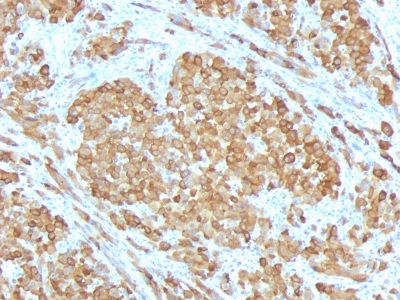 Monoclonal Antibody to MART-1 / Melan-A / MLANA (Melanoma Marker)(Clone : SPM555)