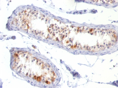 Monoclonal Antibody to MART-1 / Melan-A / MLANA (Melanoma Marker)(Clone : MLANA/788)