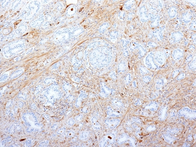 Monoclonal Antibody to Fibronectin(Clone : SPM539)