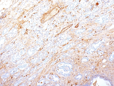 Monoclonal Antibody to Fibronectin(Clone : SPM246)