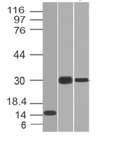 Monoclonal Antibody to CELA3B / ELA3B (Pancreatic Function Marker)(Clone : CELA3B/1218)