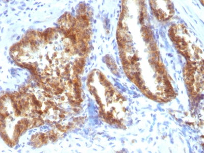 Polyclonal Antibody to AMACR / p504S (Prostate Cancer Marker)