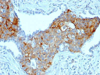 Monoclonal Antibody to TRIM29 (Lung Squamous Cell Carcinoma Marker)(Clone : TRIM29/1041)