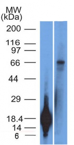 Monoclonal Antibody to TRIM29 (Lung Squamous Cell Carcinoma Marker)(Clone : TRIM29/1042)