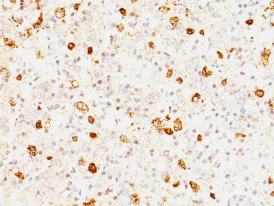 Monoclonal Antibody to FSH-beta (Follicle Stimulating Hormone-beta)(Clone : FSHb/1062)