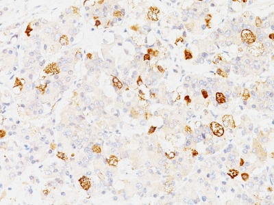 Monoclonal Antibody to FSH-beta (Follicle Stimulating Hormone-beta)(Clone : SPM107)