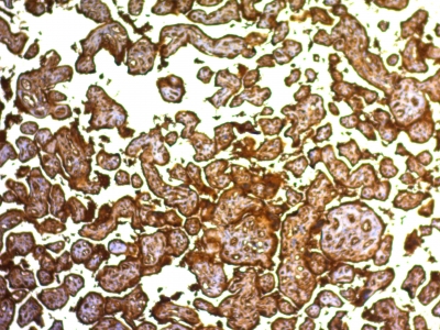 Monoclonal Antibody to Placental Alkaline Phosphatase (PLAP) (Germ Cell Tumor Marker)(Clone : SPM593)