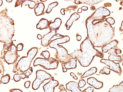 Monoclonal Antibody to Alkaline Phosphatase (Placental) / PLAP (Germ Cell Tumor Marker)(Clone : GM022)