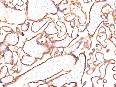 Monoclonal Antibody to Alkaline Phosphatase (Placental) / PLAP (Germ Cell Tumor Marker)(Clone : PL8-F6)