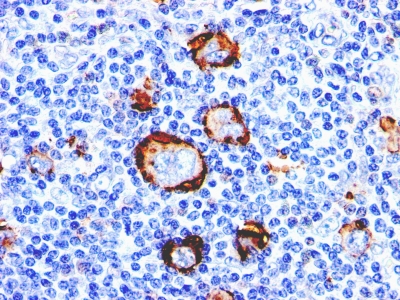 Monoclonal Antibody to CD15 / FUT4 (Reed-Sternberg Cell Marker)(Clone : Leu-M1; same as MMA)