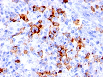 Monoclonal Antibody to CD15 / FUT4 (Reed-Sternberg Cell Marker)(Clone : BRA-4F1)