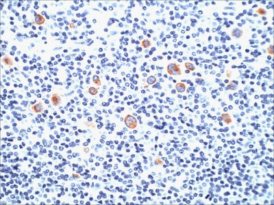 Monoclonal Antibody to CD15 / FUT4 (Reed-Sternberg Cell Marker)(Clone : SPM490)