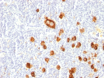 Monoclonal Antibody to CD15 / FUT4 (Reed-Sternberg Cell Marker)(Clone : FUT4/815)