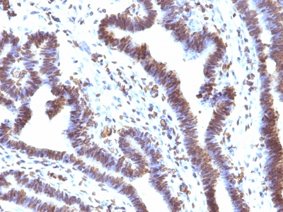 Monoclonal Antibody to EMI1 (Early Mitotic Inhibitor-1)(Clone : EMI1/1176)