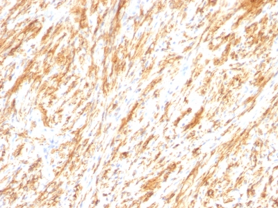 Monoclonal Antibody to GFAP (Astrocyte & Neural Stem Cell Marker)(Clone : SPM248)