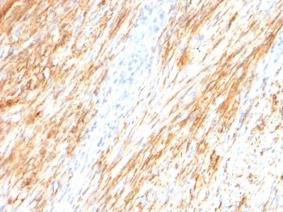 Monoclonal Antibody to GFAP (Astrocyte & Neural Stem Cell Marker)(Clone : ASTRO/789)