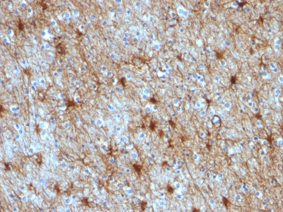 Monoclonal Antibody to GFAP (Astrocyte & Neural Stem Cell Marker)(GA-5 + ASTRO/789)