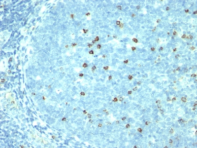 Monoclonal Antibody to CD57 / B3GAT1 (Natural Killer Cell Marker)(Clone : SPM527)