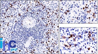 Monoclonal Antibody to CD57 / B3GAT1 (Natural Killer Cell Marker)(Clone : NK-1)