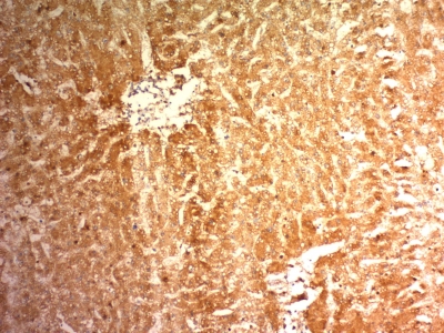 Monoclonal Antibody to Glypican-3 (GPC3) (Hepatocellular Carcinoma Marker)(Clone : 1G12)