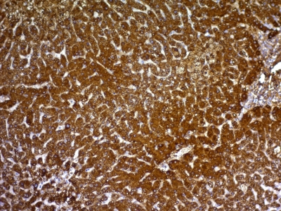 Monoclonal Antibody to Glypican-3 (GPC3) (Hepatocellular Carcinoma Marker)(Clone : GPC3/863)