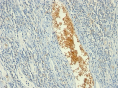 Monoclonal Antibody to AMP Deaminase, Isoform E (AMPD3) (Erythroid Marker)(Clone : AMPD3/901)