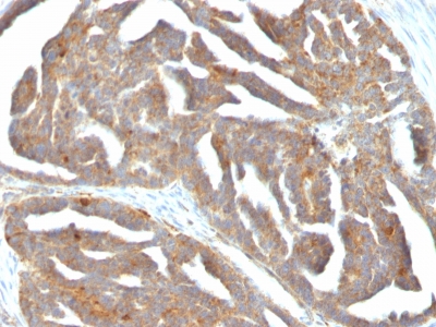 Monoclonal Antibody to GnRH-Receptor / LH-RH Receptor(Clone : F1G4; same as GNRH03)