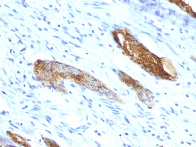 Monoclonal Antibody to Blood Group Antigen A (CD173)(Clone : 33C13)(Discontinued)