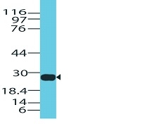 Polyclonal Antibody to Granzyme B (NK/T-Cell Lymphoma Marker)(Discontinued)