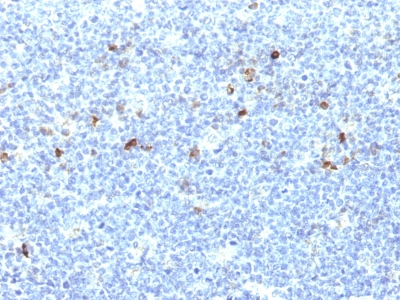 Monoclonal Antibody to HLA-Aw32 & HLA-A25 (MHC I)(Clone : CATA-1)