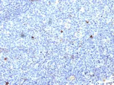 Monoclonal Antibody to HLA-Aw32 & HLA-A25 (MHC I)(Clone : SPM418)