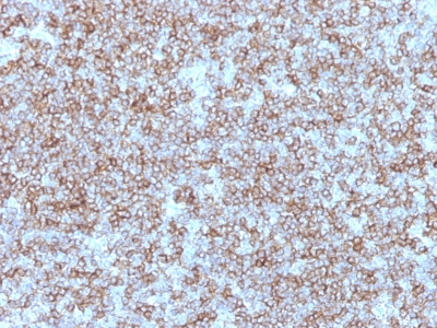 Monoclonal Antibody to HLA-DP/-DR (MHC II)(Clone : Bra-14)