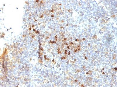 Monoclonal Antibody to HLA-DRA (MHC II)(Clone : 19-26.1; same as MB-26.1)