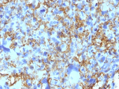 Monoclonal Antibody to HLA-DRB (MHC II)(Clone : LN-3)