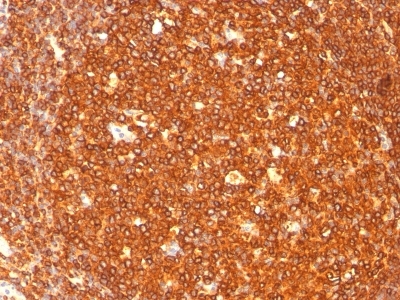 Monoclonal Antibody to HLA-DRB (MHC II)(Clone : SPM289)