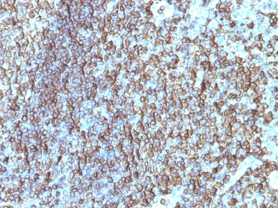 Monoclonal Antibody to HLA-DRB (MHC II)(Clone : SPM288)